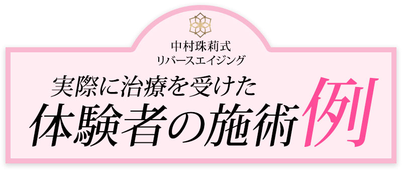 リバースエイジング イメージ